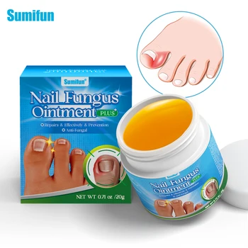 Good Effect Sumifun Anti Fungal Nail Infection Herbal Toe Nail Fungus 