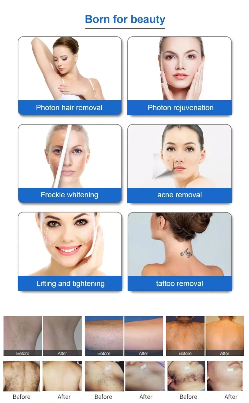 Portable 2 in 1 Q Switch IPL Hair Removal and Nd Yag Laser Pigmentation Tattoo Removal Machine for Women and Men