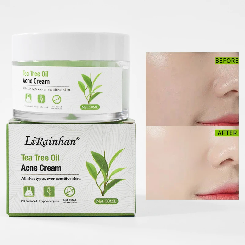 OEM Private Label Organic Tea Tree Oil Acne Face Cream Skin Care Acne Removal Moisturizer Hydrating Anti Acne Facial Cream
