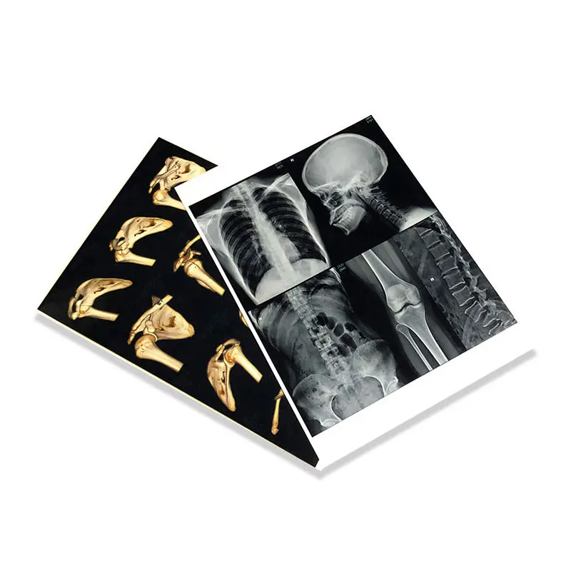 Laser Printing Blue PVC Medical Telugu High Quality Blue Laser Film Videos