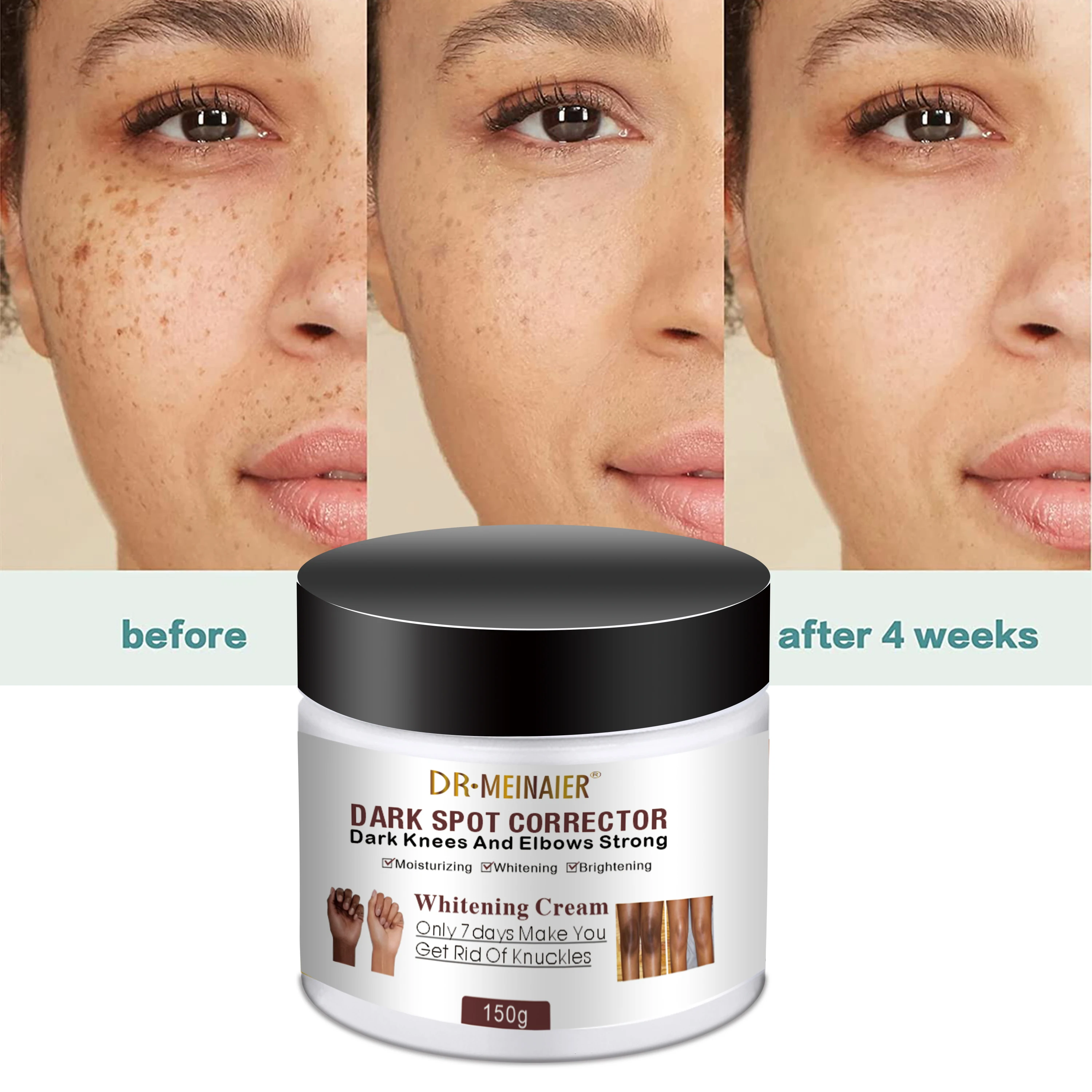 Crème Ultra Éclaircissante GLUTAMASTER - Traitement Acné & Taches 7 Days