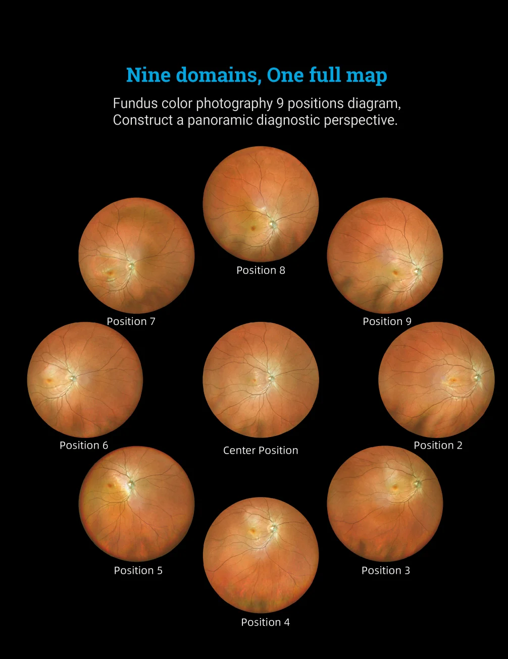 170&deg; Ultra Wide Field Fundus Imaging System Retinal Camera with Four Laser Sources and Automatic Eye Positioning