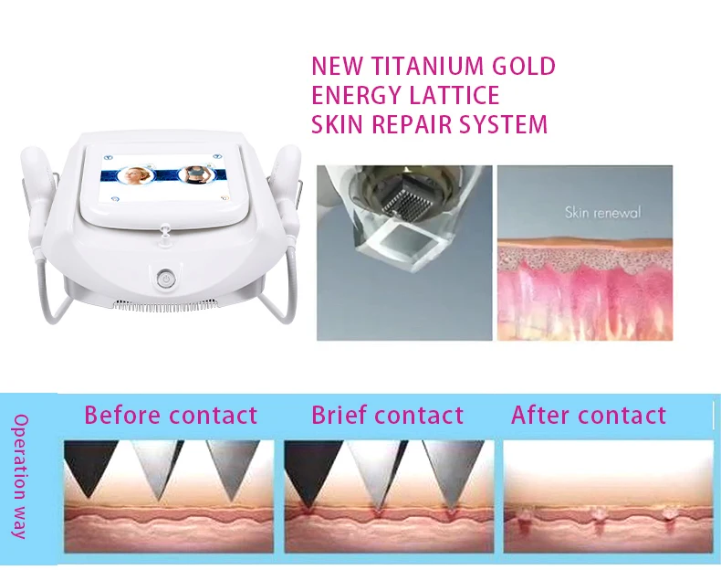 Hot Sale Titanium Gold Cartridge Microneedling Frequency Fractional Rf