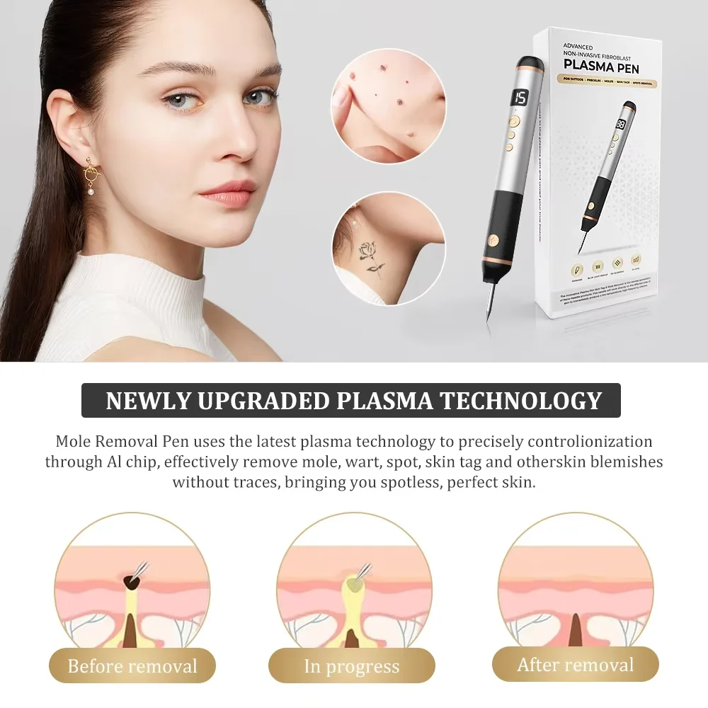 15-Level Painless Plasma Pen Cauterizer Tag Removal Electrocautery Skin Eraser for Face Wart Papilloma Mole Pen