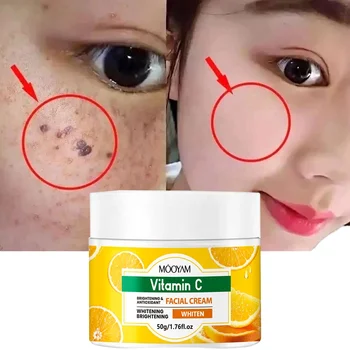 VC Strong Bleaching Whitening Face Cream 50g for Melasma Dark Spot Removal Freckles Corrector GMP Azelaic Acid Arbutin Ceramide
