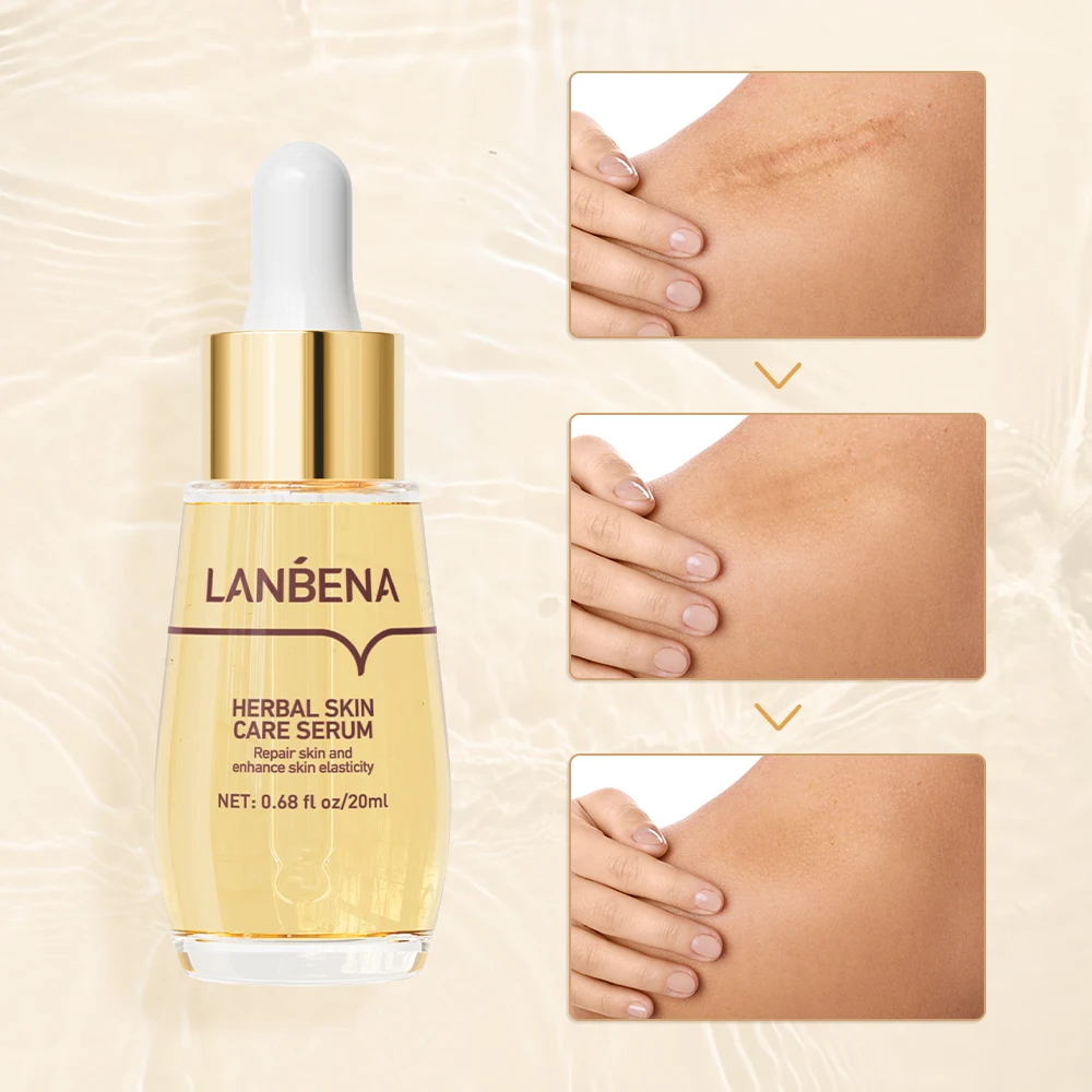 LANBENA Herbal Skin Repair Acne Scar Removal Serum Removal Stretch Marks Oil factory