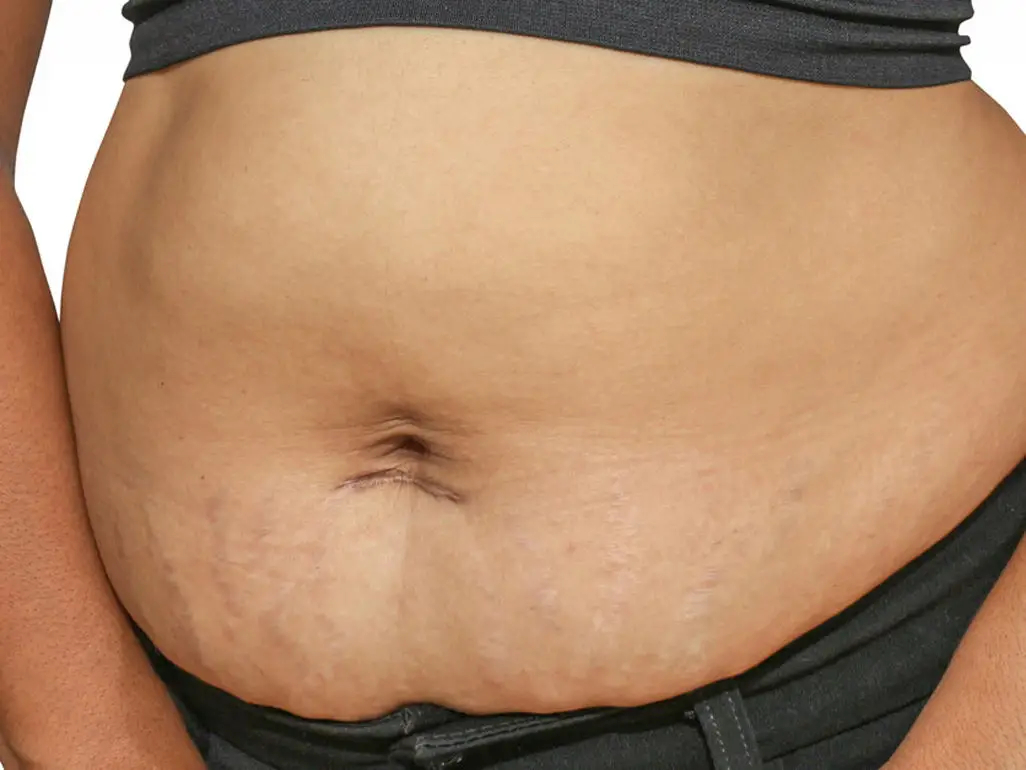 костюм ems костюм ems