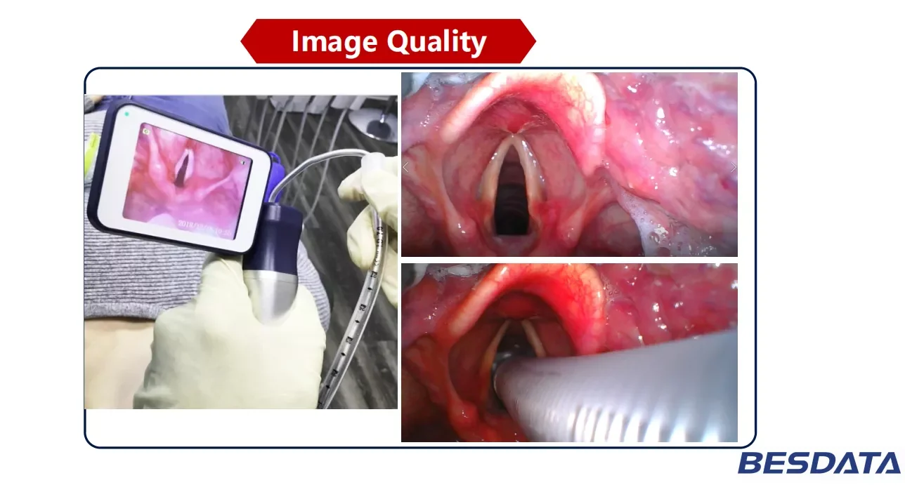 Cheap Price Reusable Video Laryngoscope Set With 3inch Display 6size Blade MAC Miller for Neonatal Pediatrics Adults Emergency