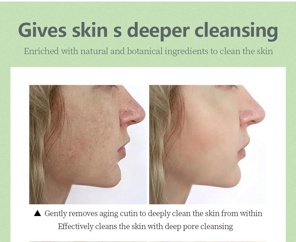 OEM Custom Logo Ointment Moisturizing Skin Cream Color Box Moisturize and Delay Aging; Effectively Remove The Black Eye All Age