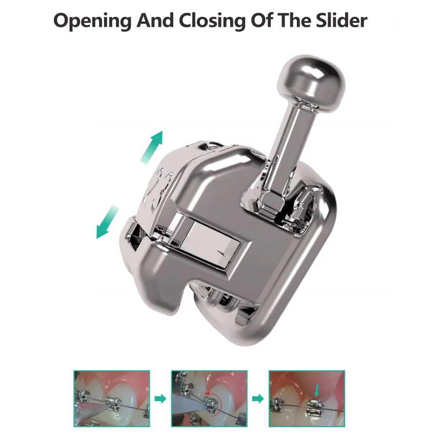 Protect Factory Direct Metal Bracket Braces Orthodontic Selfligating