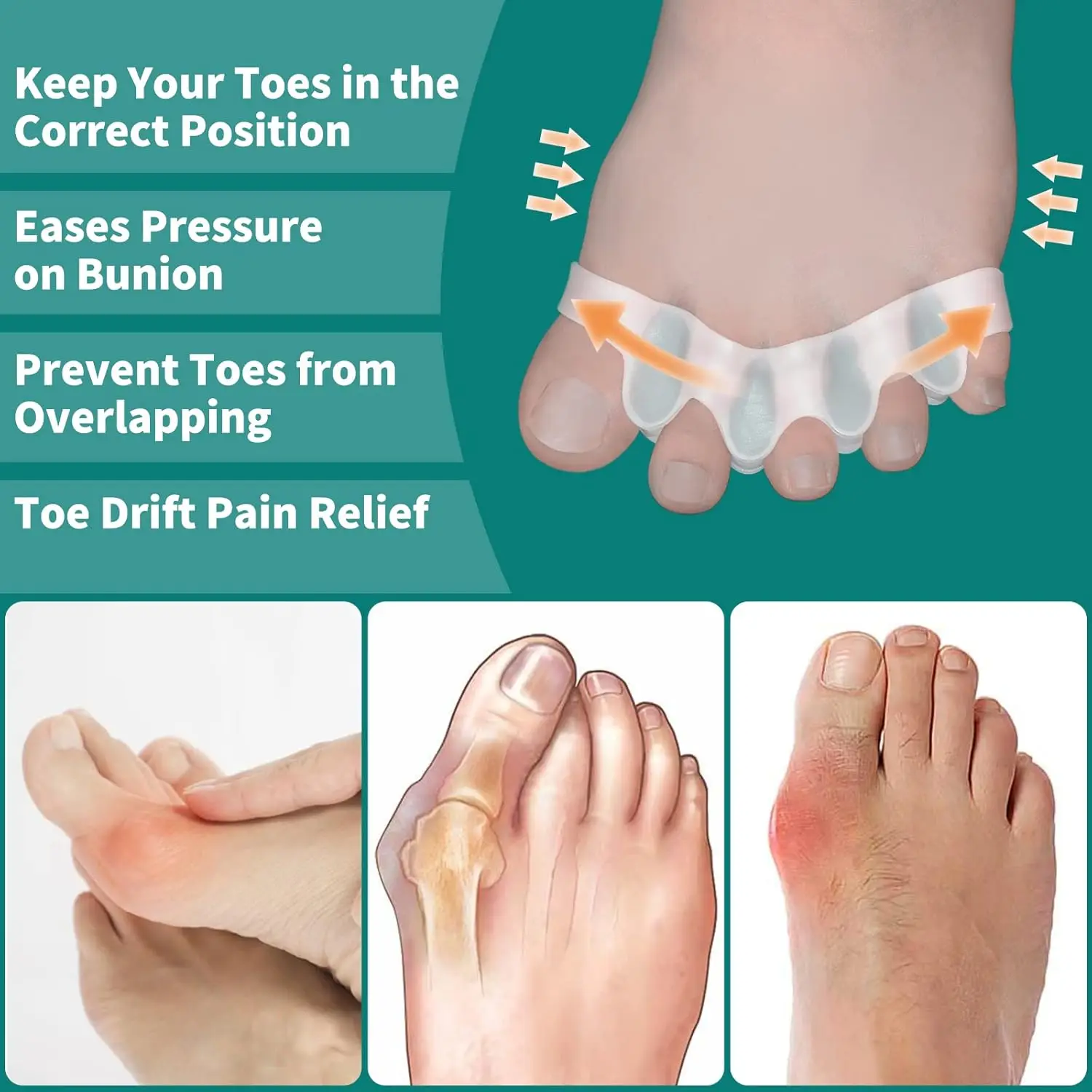 SEBS Durable Five-Hole Toe Separators for Men and Women Bunions Corrector and Toes Restorer Arch Supports