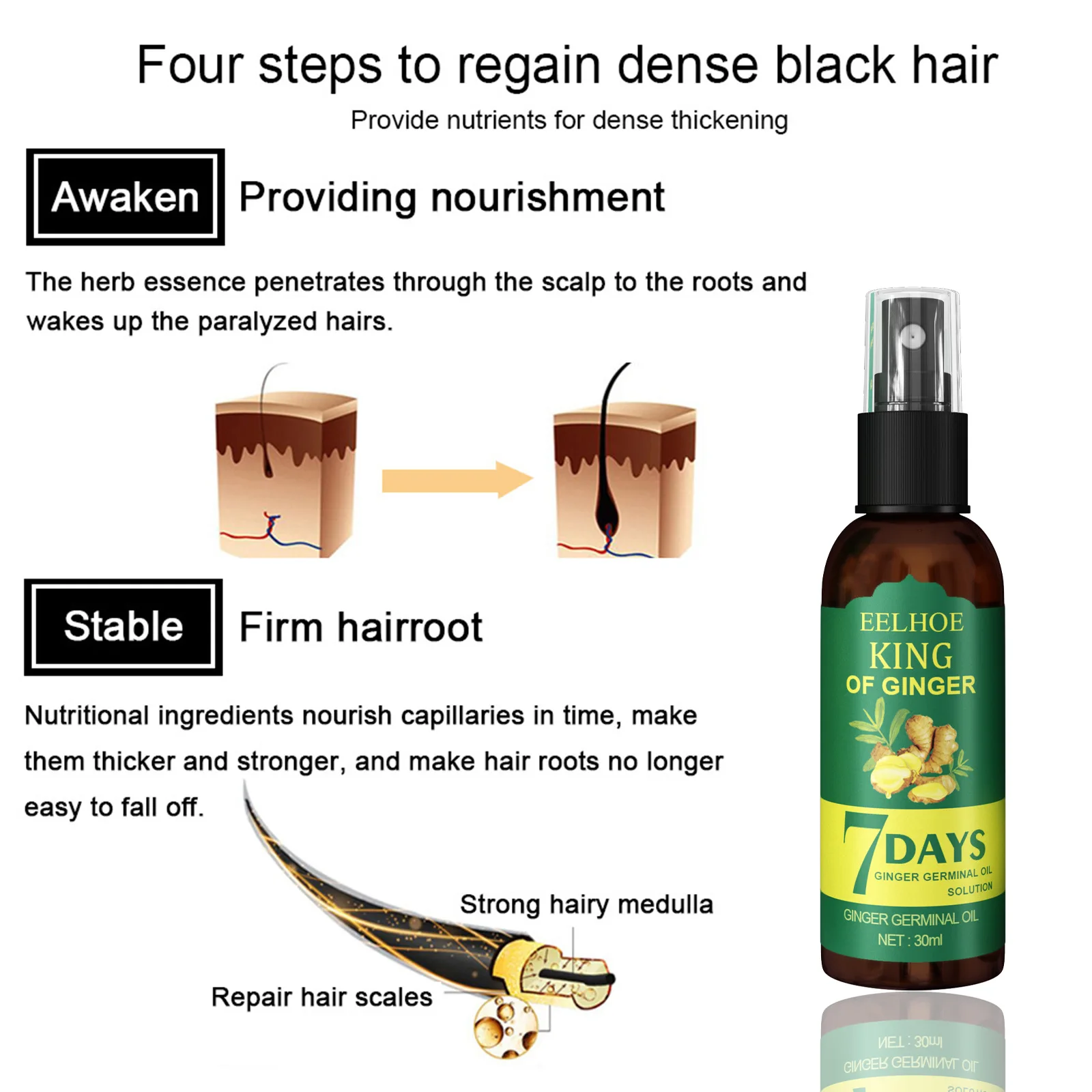 eelhoe roi de gingembre à base de plantes cheveux réparation huile mélange  7 jours gingembre solution d'huile germinale meilleur cheveux croissance  huile spray pour femme