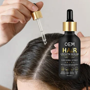 OEM ODM Hair Regrowth Treatment Plant Extract Private Label Hair Growth Serum For Hair Thinning