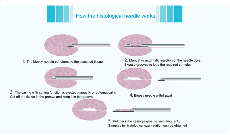 prostate lung disposable automatic histological biopsy needle 18G*250mm