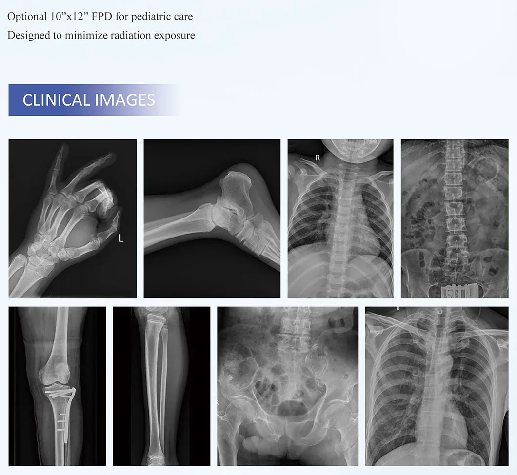 Best Price Radiography Department Medical Diagnostic Equipment X Ray Equipment Digital Mobile X-ray System manufacture