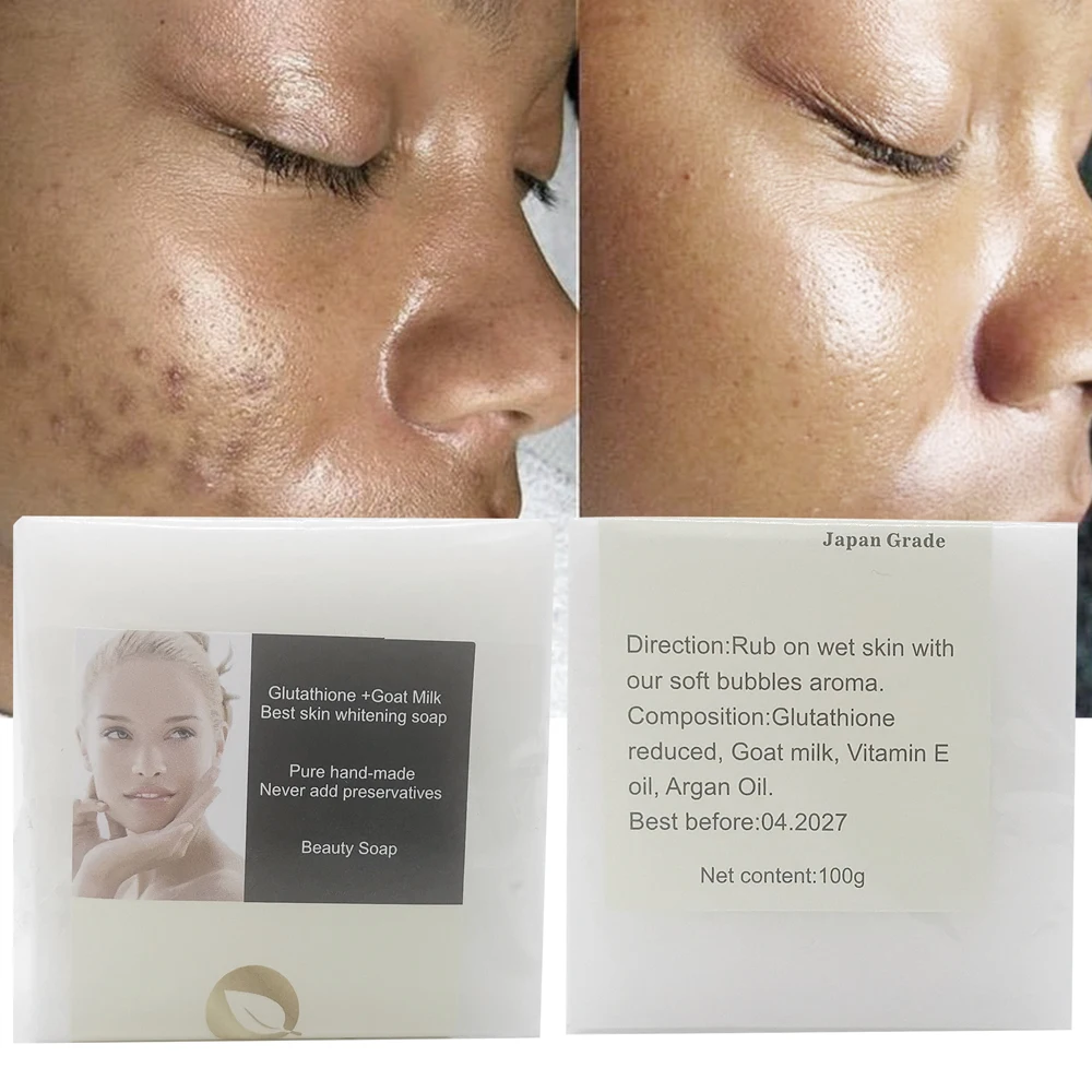 glutathione bath soap Gluta Green Glutathione Whitening Soap Bar – Adraneda Dermatology &  Cosmetic Surgery Clinic