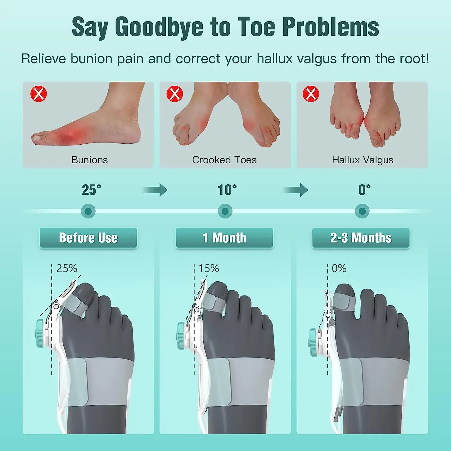 New Arrival Adjustable Big Toe Splint Foot Bone Protrusion Overlapping Toe Separator Hallux Valgus Bunion Corrector