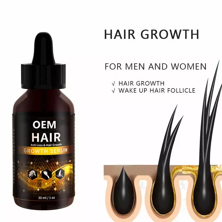 Wholesale Hair Loss Products For African 100% Natural Organic Private ...