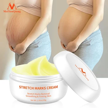 Custom logo Private Label OEM Pregnancy Mark Fading Skin Smoothing Firming Stretch Marks Removing Cream for Pregnant Women