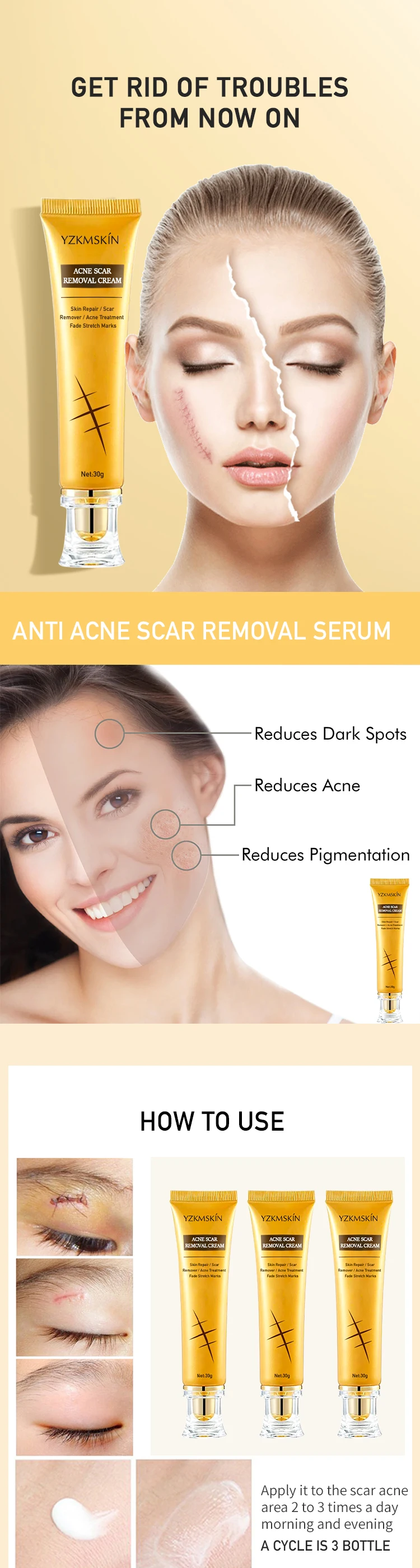 Wholesale Custom Facial Scar Repair Cream Facial Dark Spot Anti Acne