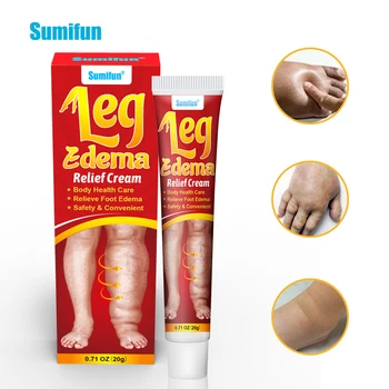 New Product Sumifun 20g Cream for Leg Edema Body Care Cream