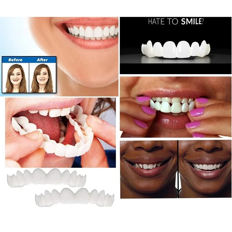 Teeth Veneers Whitening Dentures Imitation Braces Temporary False Teeth