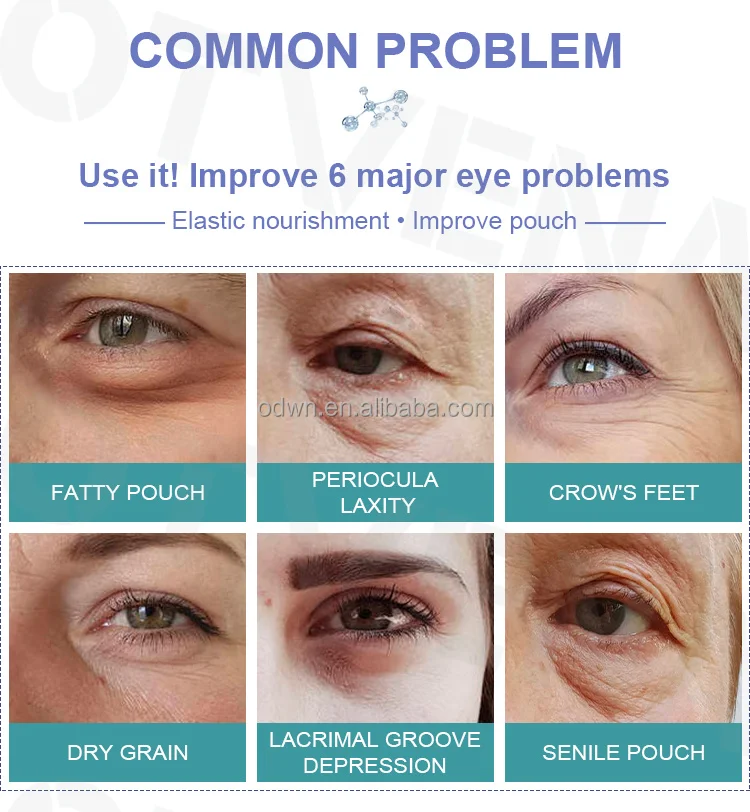OTVENA Factory Customize Best 1ml Wrinkle Eye Bags Removal Under Eye Cream for Dark Circle and Puffiness