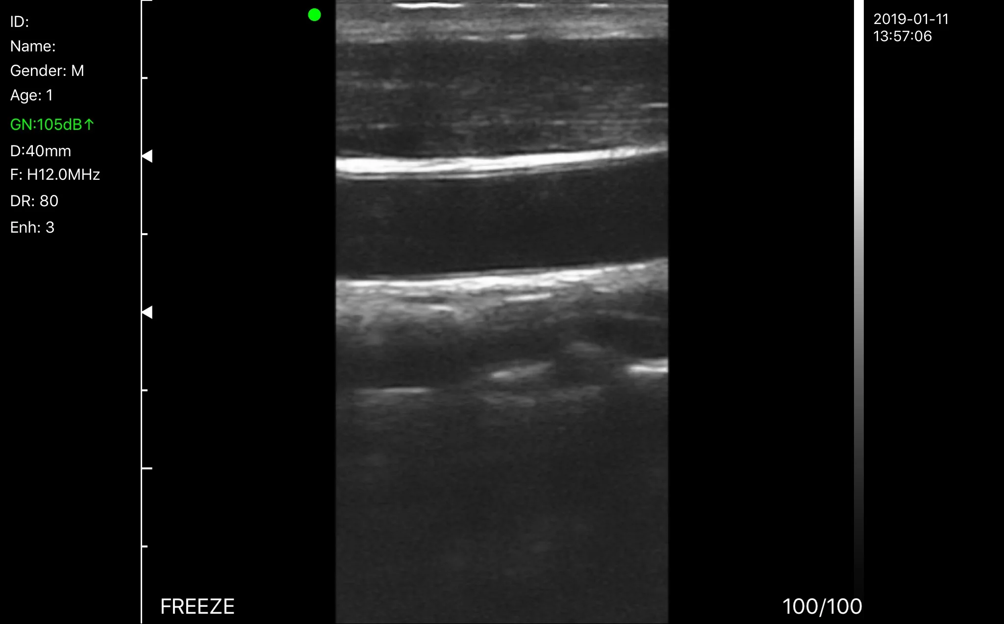 Factory Price Cardiac Sector Phased Array Probe Ultrasonic Ultrasound Linear Probe on Sale supplier