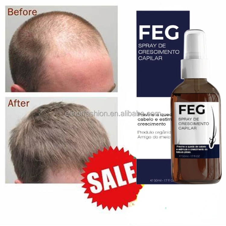 The Latest Inventions of China Ginseng Extract Polygonum YUDA Hair Growth Spray/ FEG Pilatory