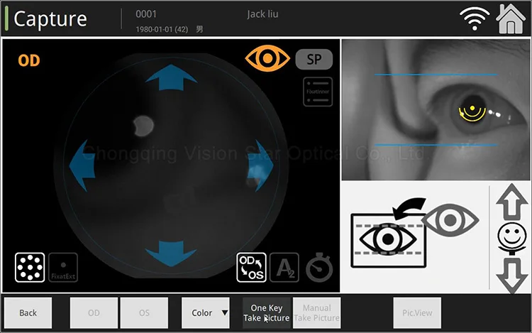 Professional Medical Equipment Non-Mydriatic Eye Fundus Camera for Retinal Examination