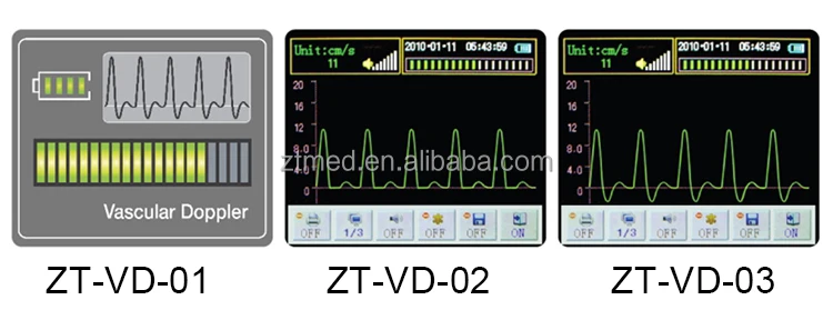 ZT-VD-01(6).jpg