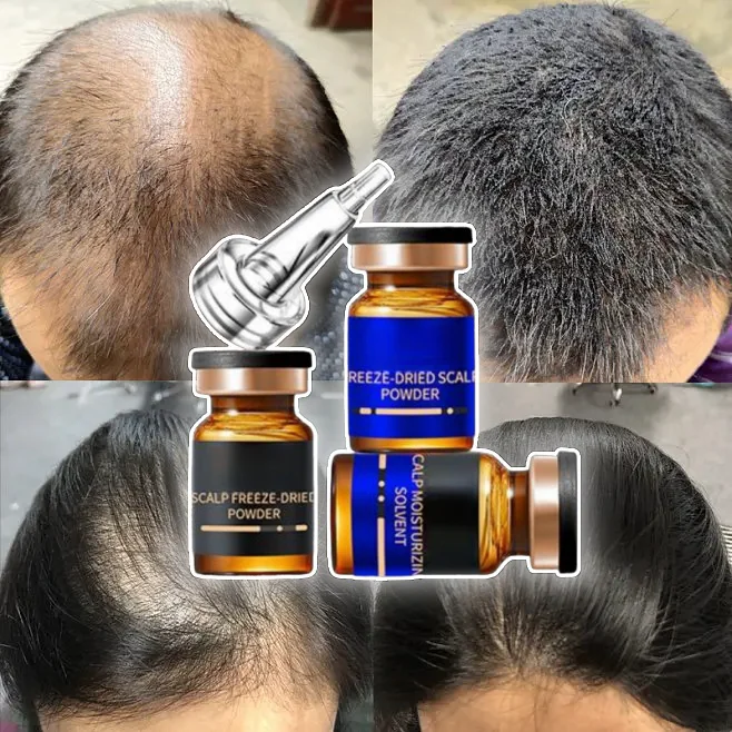 ghk cu for balding Bond Peptides GHK-CU Vial main image 1