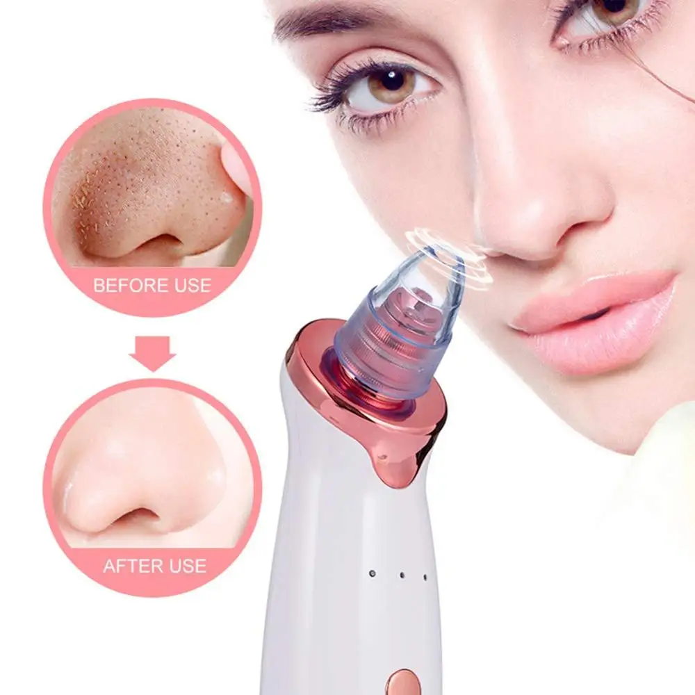 ボディ・フェイスケア Multifunctional Cleaning Instrument Multifunctional Blackhead Remover Tool | Pore Vacuum Acne