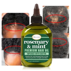 Private Label Biotin & Castor Oil & Rosemary Organic Hair Growth Oill for Black Women