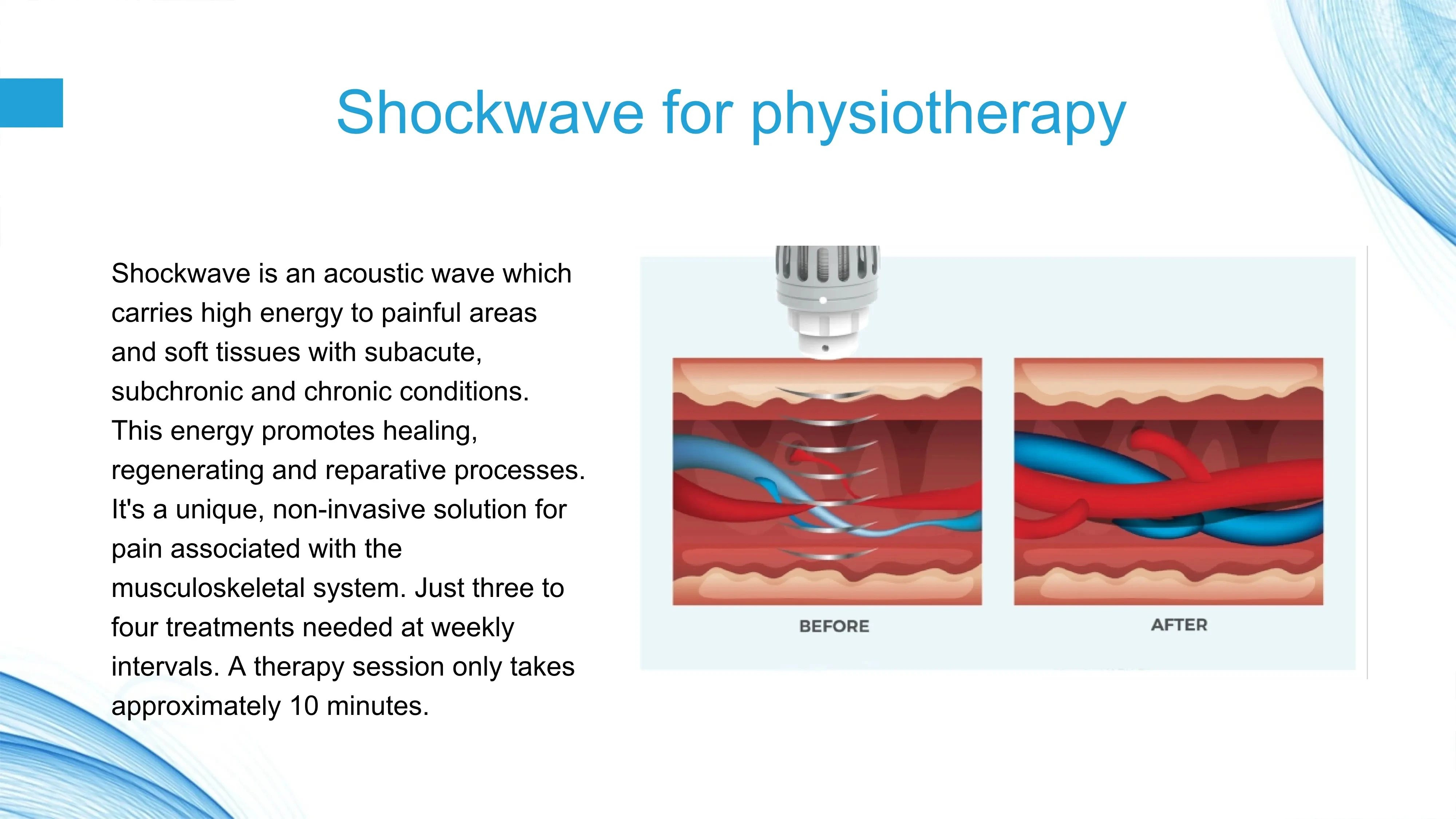 Innovative Products Effective Physiotherapy Equipment Radial Focused ED Pain Relief Shockwave Therapy Machine ESWT