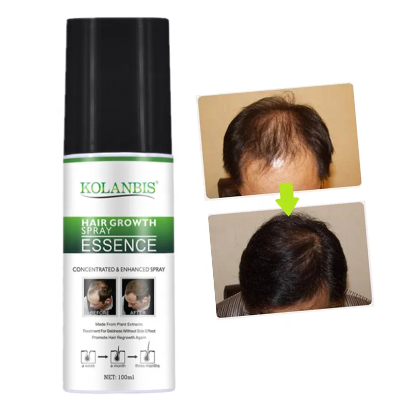 
 KOLANBIS, оптовая продажа, масло для восстановления роста волос при облысении, Лучший спрей для быстрого роста волос, лечение выпадения волос  