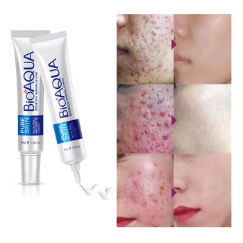 for usa men BIOAQUA mask face cream acne removing herbal acne cream pore controlling acne removal cream bulk scar
