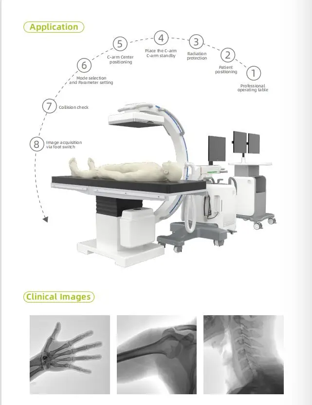 Dsa Machine Components DSA System of X Ray Digital c Arm Fluoroscopy Machine Angiograph Film ...
