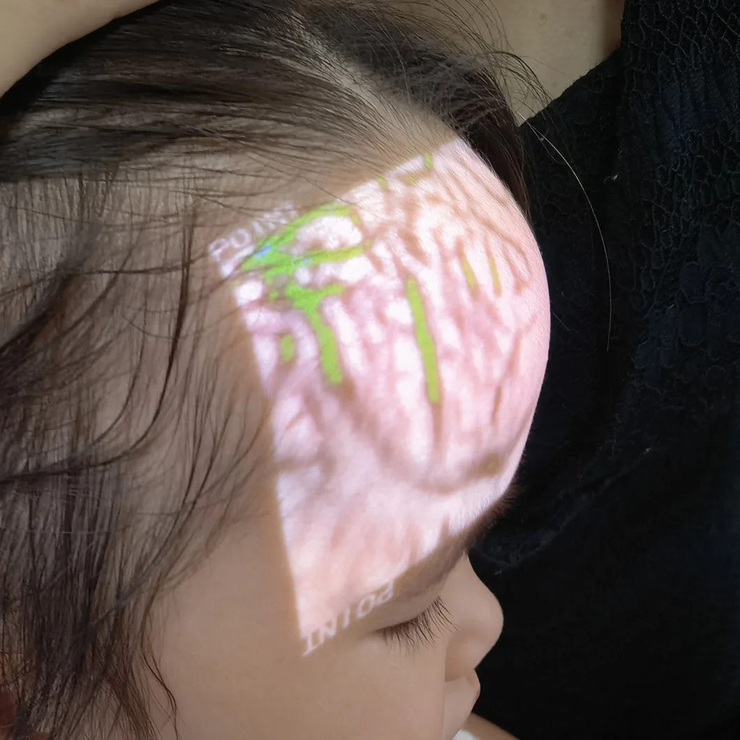 HF-410A Medical High Resolution Multiple Colors Display Handheld Portable Vein Finder Illuminator