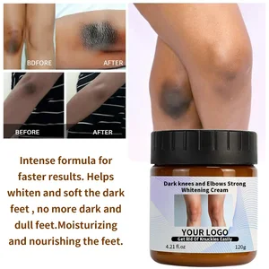Jojoba Oil Whitening Cream with Aloe Vera & Arbutin Deep Hydration for Dark & Dry Skin Lightens Knuckles Knees Elbows