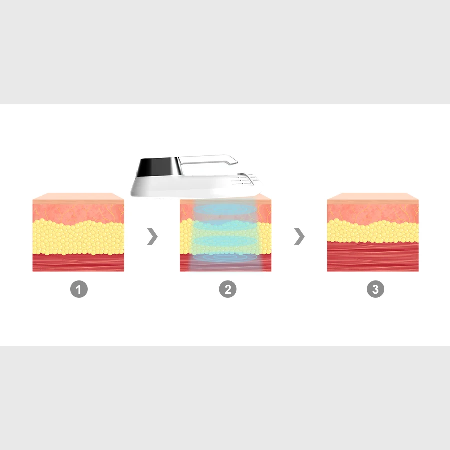 Устройство для снижения целлюлита RF устройство формирования мышц с 4 ручками сжигания жира скульптурирования тела без