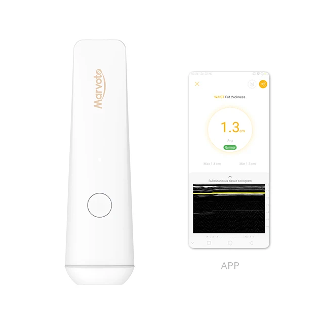 Hot Sale Belly Fat Scanner Waist/Upper arm/Thign/Calf Body Fat Analyzer