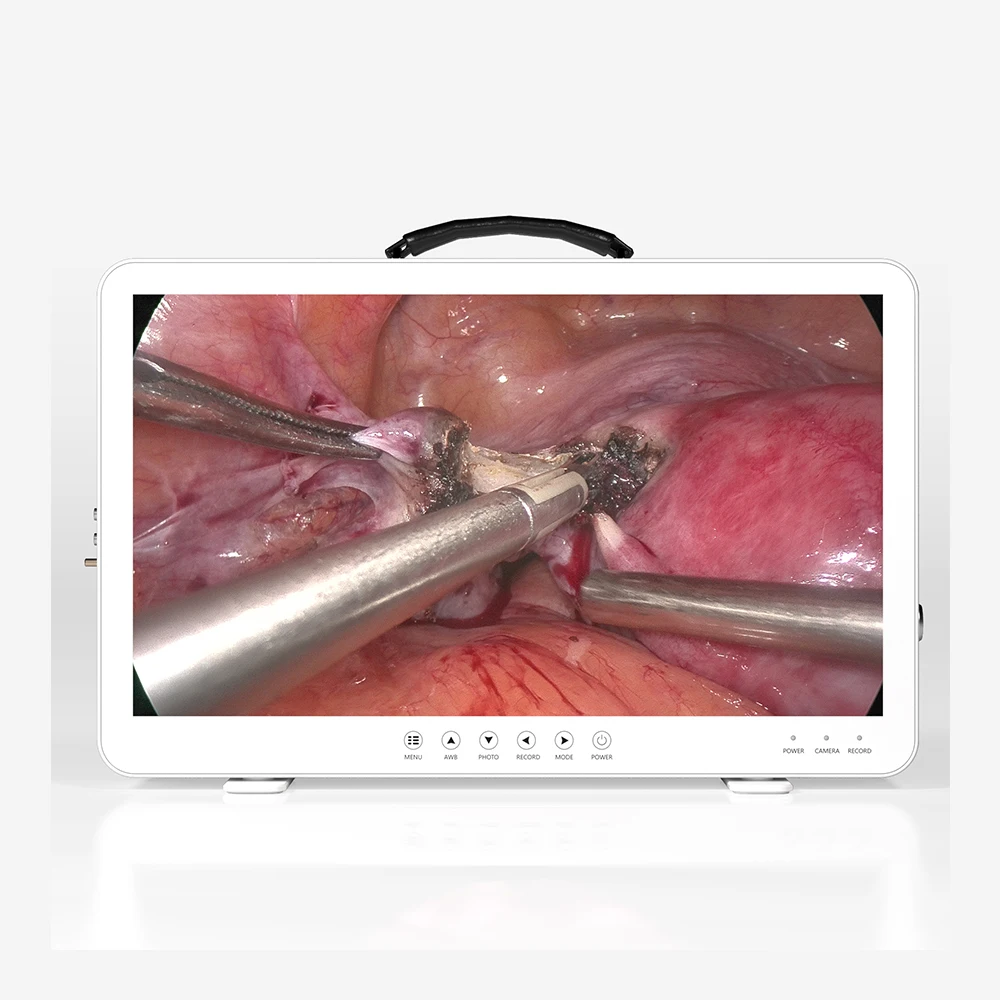 Video ear endoscope