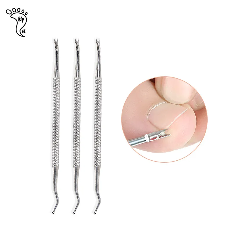 Unghie Incarnite Piedi 150PCS Unghia Incarnita Alluce Utensili Per Unghie Incarnite Strumento Per Unghie Incarnite Strisce Correttore Per Unghie Incarnite Attrezzi Per Unghie Incarnite - Foto 5