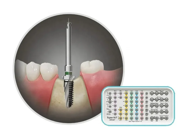 インプラントトレー CORIMPLANT Tray セット Medline Chest Tube Tray with COMFORT LOOP Instruments | Medline