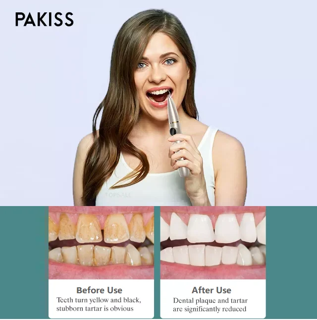 Pakiss Household Ultrasonic Electric Tooth Cleaner Dental At Home