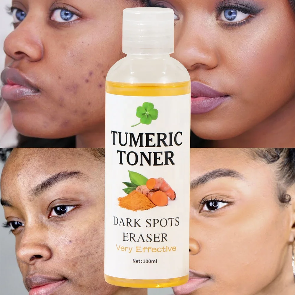 Private Label Dark Spots Eraser Turmeric Toner Brightening Fades