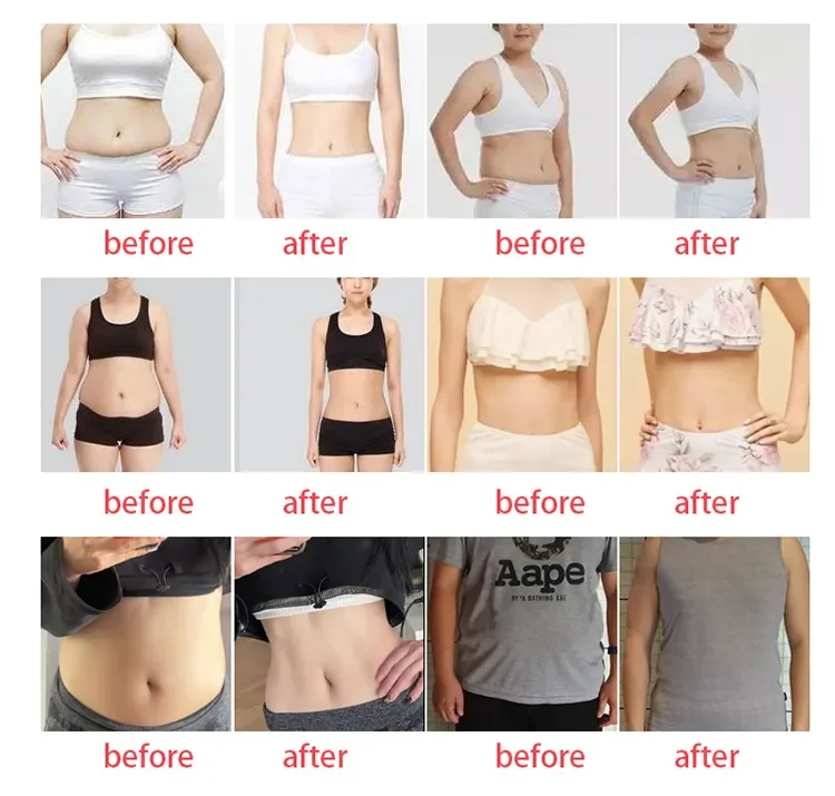 <p data-pm-slice="1 1 []">The <strong>360° Cryolipolysis and Body Sculpting Machine</strong> combines controlled cooling with multiple aesthetic technologies in one professional system. Equipped with large and medium cryolipolysis heads, a 40 kHz ultrasonic cavitation handle, 6-polar body RF, face RF, and eight large lipo laser pads, it gives beauty salons, med spas, and aesthetic clinics a versatile platform for body contouring and skin-firming service programs.</p> Featuring an 8-inch touchscreen, this multifunction aesthetic machine supports a more organized treatment workflow while helping businesses expand their body and facial treatment menus without purchasing separate devices for each modality. 360° Cryolipolysis and Body Sculpting Machine with Cavitation RF & Lipo Laser
