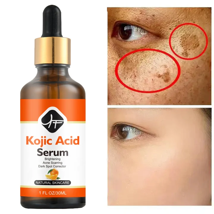 kojic soap glutathione The Good Peel