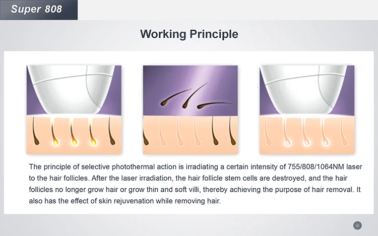 2023 Hot Sale Professional Beauty Machine Laser 808nm Hair Removal Diode 808 755 1064 Diode Laser Hair Removal